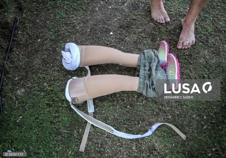 Palestina: Campo de férias para crianças amputadas