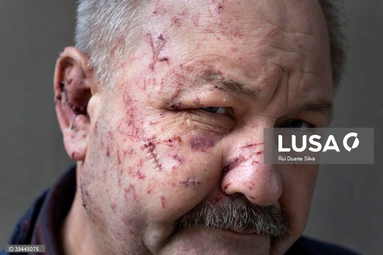 03-10 -Rui Duarte Silva é o vencedor da categoria Notícias nos prémios de fotojornalismo Estação Imagem 2022 com uma reportagem no cenário de guerra ucraniano desencadeado pela invasão da Rússia. Coimbra 17 de setembro de 2022. RUI DUARTE SILVA / ESTAÇÃO IMAGEM / LUSA +++PROIBIDA A COMERCIALIZAÇÃO+++ 