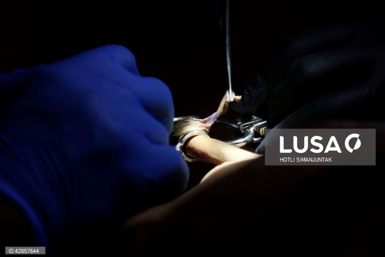 Indonésia: Circuncisão em massa marcando a chegada da puberdade em Aceh