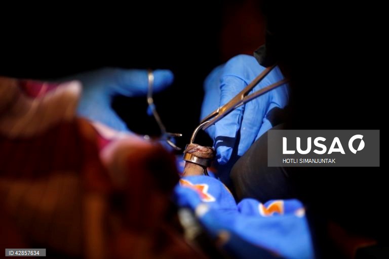 Indonésia: Circuncisão em massa marcando a chegada da puberdade em Aceh