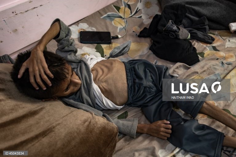 Faixa de Gaza: Tratamento de crianças desnutridas em Khan Yunis