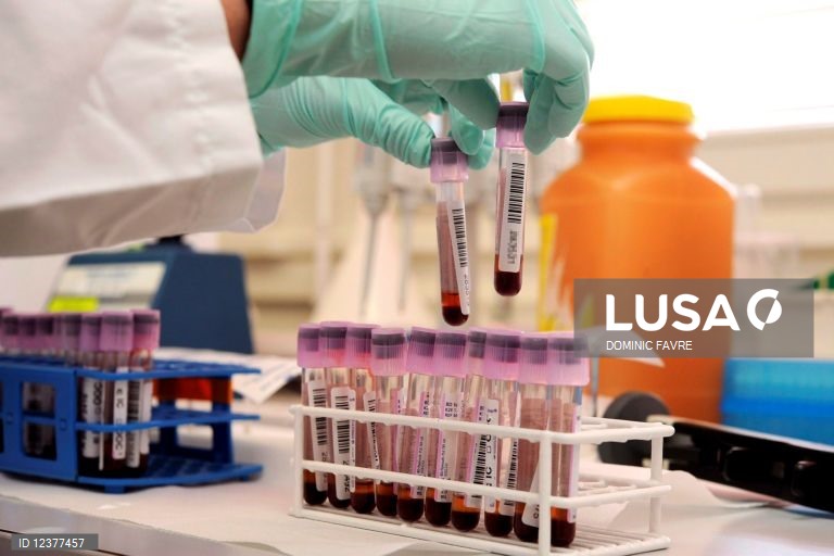 Análise ao sangue poderá substituir amostras de medula óssea na deteção da leucemia