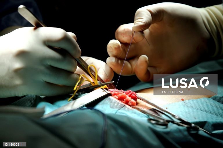 Mais de 13.400 utentes aguardavam por uma cirurgia nos Açores no final de fevereiro