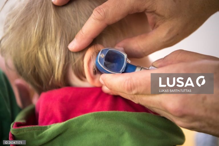 Sarampo com transmissão em países europeus e Portugal com 21 casos em 2025 - relatório