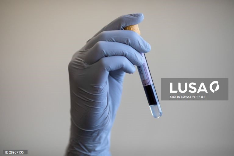 Covid-19: Mais duas mortes e 135 novos casos de infeção - DGS