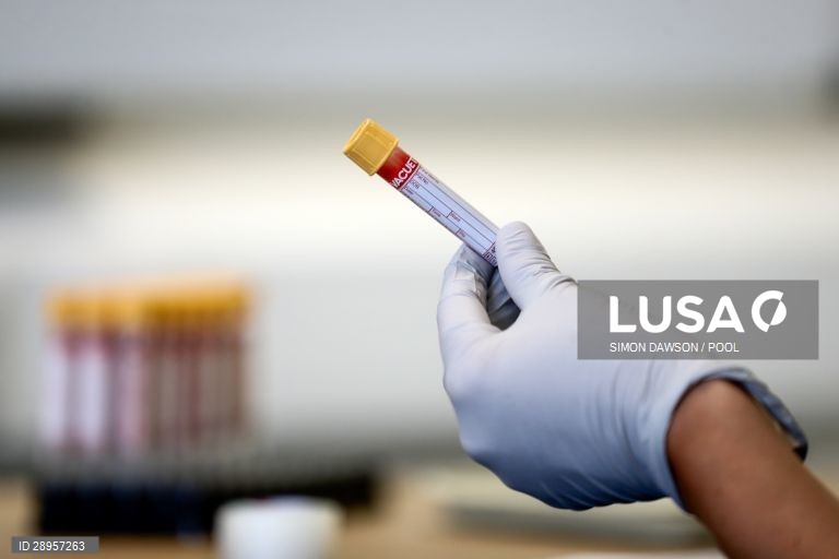 Covid-19: Portugal regista hoje mais um morto e 112 novos casos de infeção