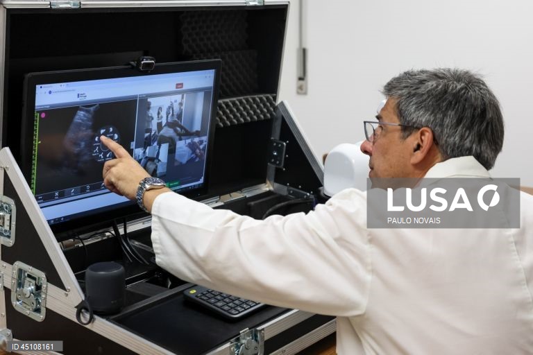 ULS de Coimbra testa tecnologia inovadora para realizar ecografias à distância