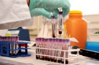 Prisões angolanas de Benguela, Cunene e Bengo lideram taxas de VIH, hepatite e sífilis