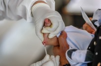 Médicos lusófonos querem mais divulgação pública da doença falciforme