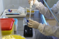 Hantavírus: Centro europeu sem razões para suspeitar que se trata de nova estirpe