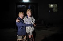 Perita da ONU diz que educação pode travar perseguição a pessoas com albinismo em África