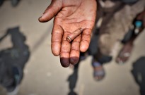 Mulher baleada "por lapso" pela polícia moçambicana