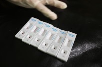 Angola regista 13 mil mortes e 28 mil novas infeções anuais por VIH/SIDA
