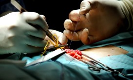 Mais de 13.400 utentes aguardavam por uma cirurgia nos Açores no final de fevereiro