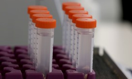 Estudo do i3S mostra que reposição de vitamina C no cérebro atrasa Alzheimer