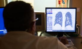 Associação critica falta de vontade política no rastreio do cancro do pulmão