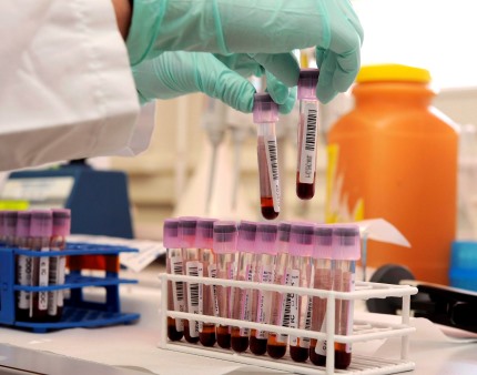 Prisões angolanas de Benguela, Cunene e Bengo lideram taxas de VIH, hepatite e sífilis